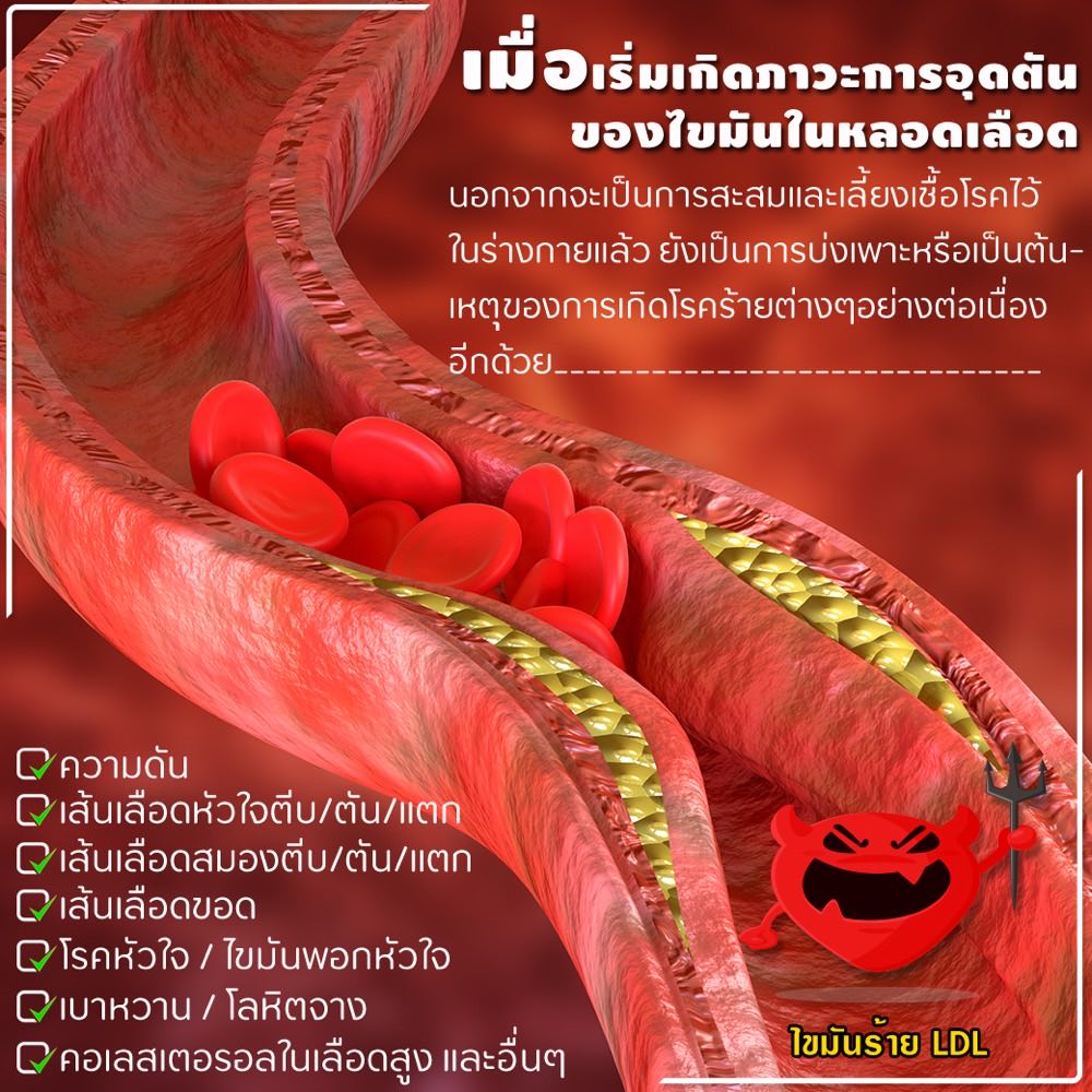 LDL ไขมันตัวร้าย ต่างจาก HDL อย่างไร